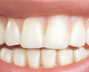 Świeży oddech bez chemii: 12 naturalnych sposobów, które działają
